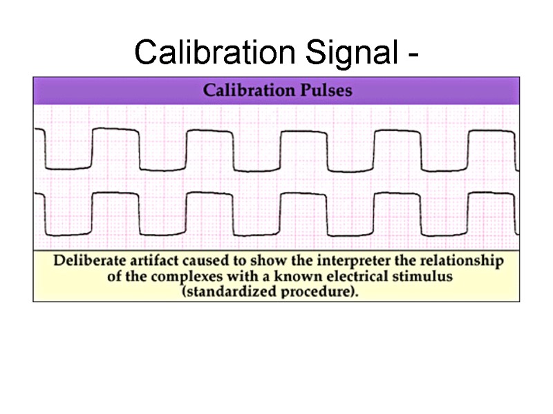 Calibration Signal -